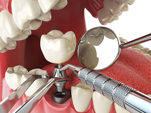 Best Orthodontic Emergency Dentist in Alderson, WV